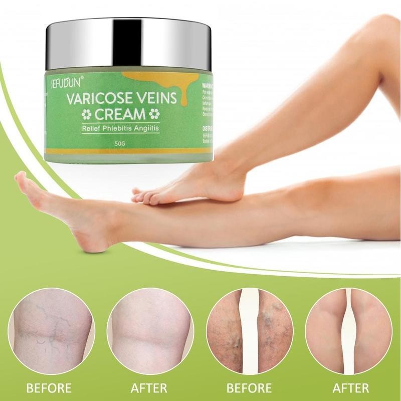 Safflower Ointment Varicose Cream - TTP