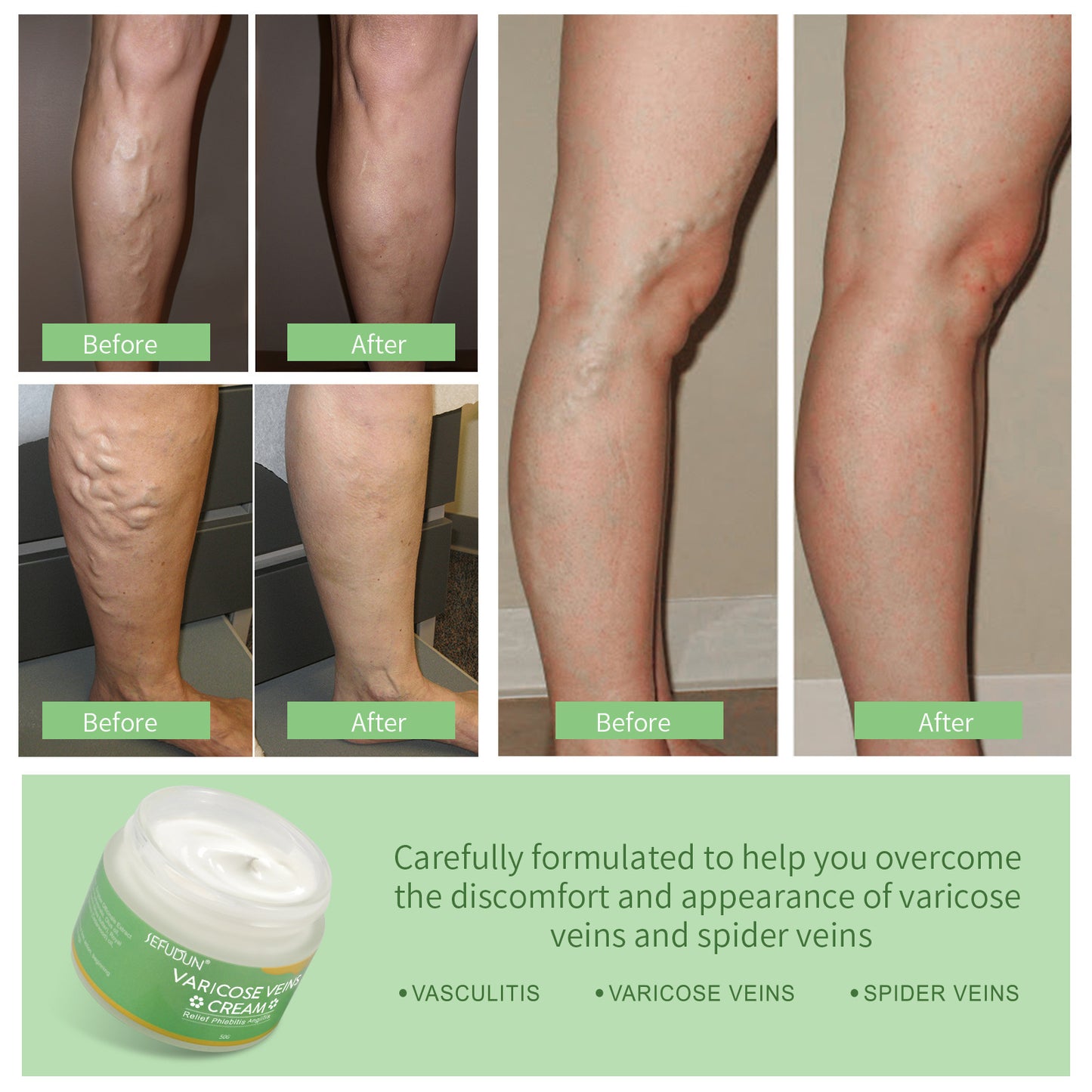 Safflower Ointment Varicose Cream - TTP