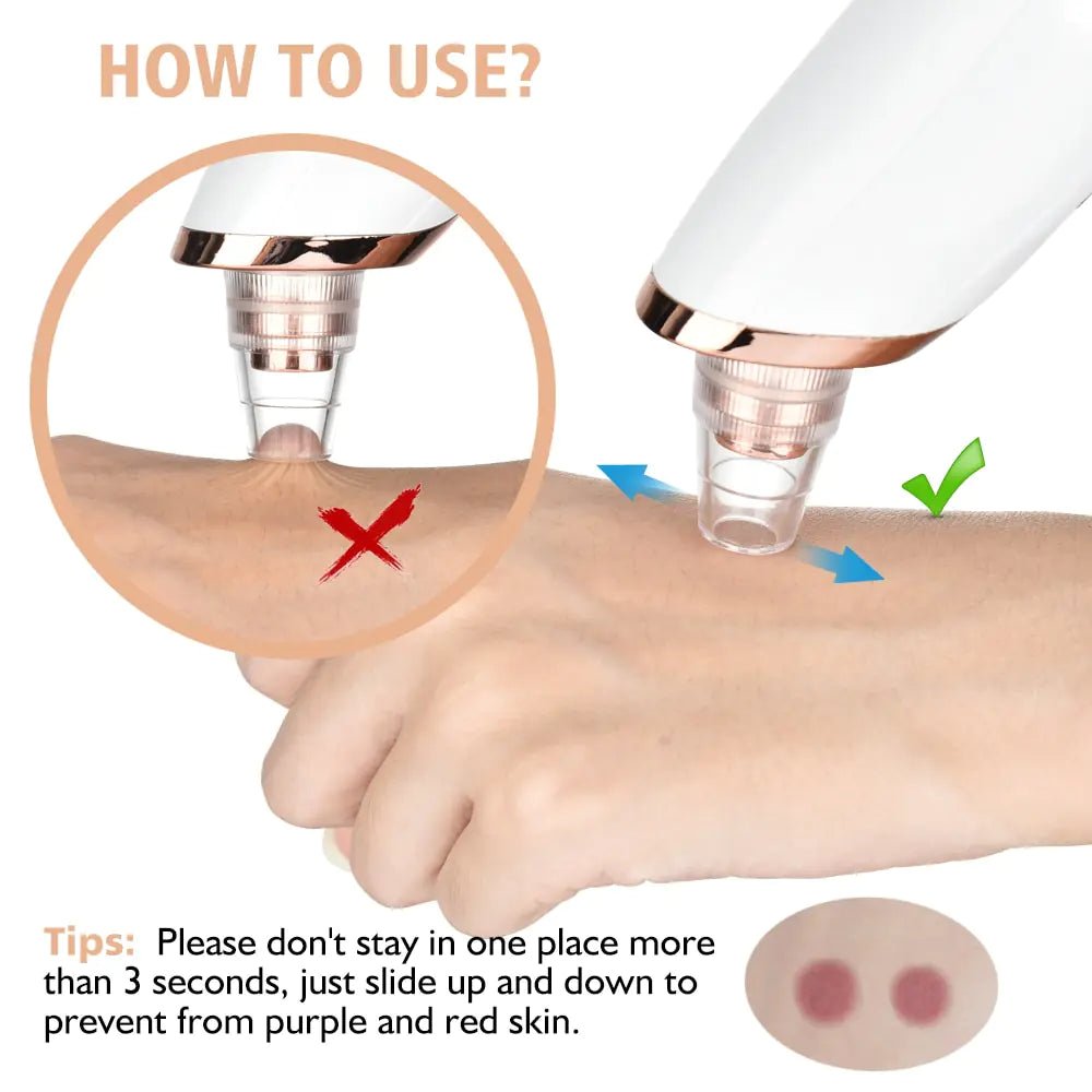 Beauty Electric Blackhead Remover - TTP